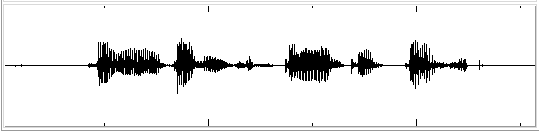 Speech signal