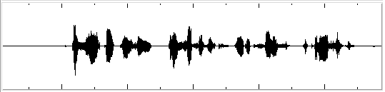 Speech signal